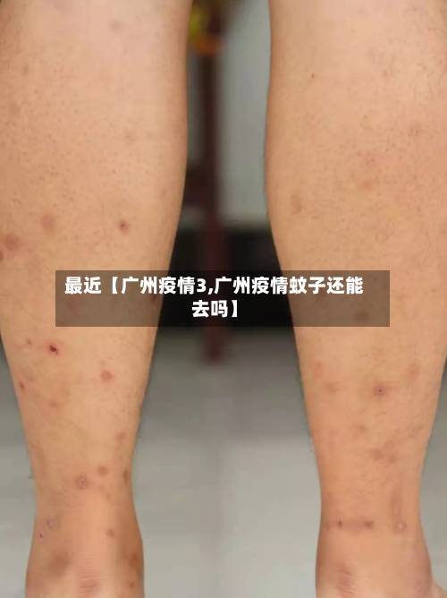 最近【广州疫情3,广州疫情蚊子还能去吗】-第2张图片